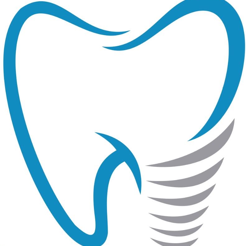 dental implant diagram